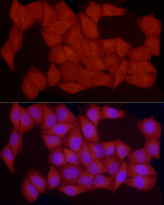 PKA C-beta (PRKACB) Rabbit pAb