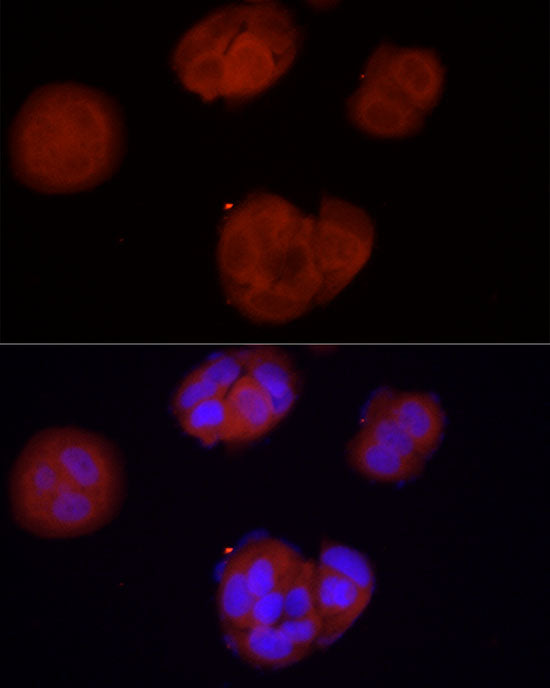 PKA C-beta (PRKACB) Rabbit pAb