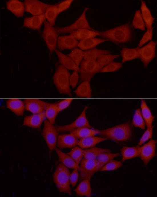 PKA C-beta (PRKACB) Rabbit pAb