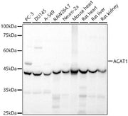 ACAT1 Rabbit pAb