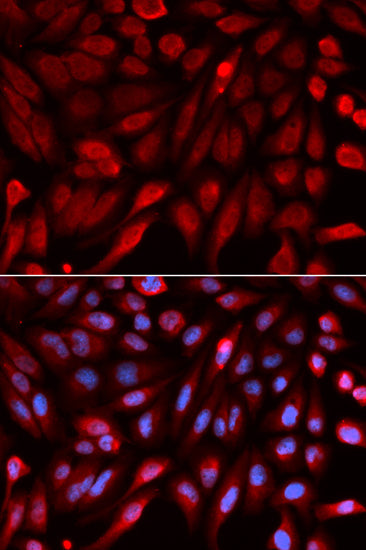 Syntenin Rabbit pAb