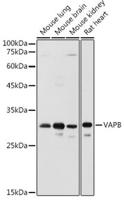 VAPB Rabbit pAb