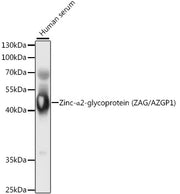 Zinc-α2-glycoprotein (ZAG/AZGP1) Rabbit pAb