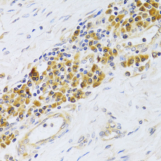 EBP1/PA2G4  Rabbit pAb