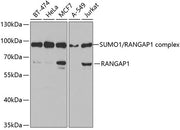 RanGAP1 Rabbit pAb