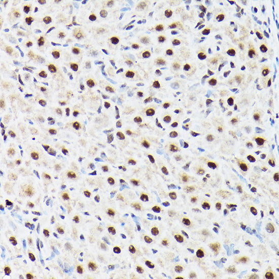 ACTL6A Rabbit pAb