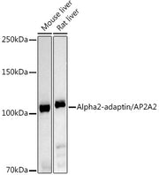 Alpha2-adaptin/AP2A2 Rabbit pAb