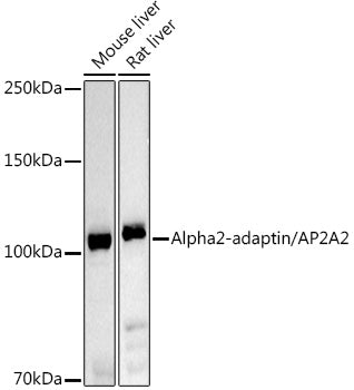 Alpha2-adaptin/AP2A2 Rabbit pAb