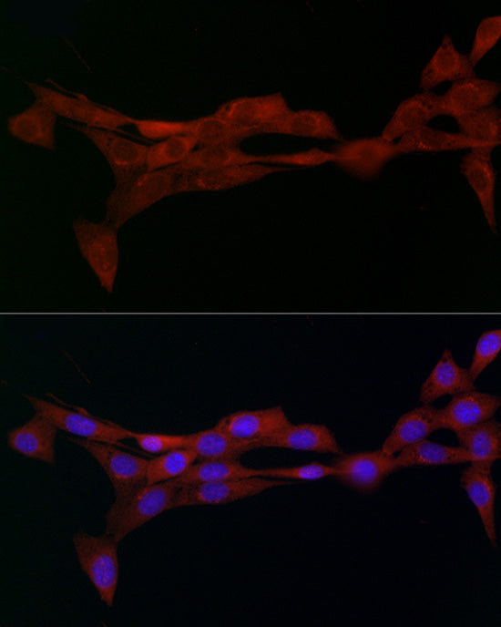 Alpha2-adaptin/AP2A2 Rabbit pAb