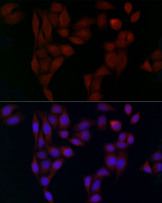 Alpha2-adaptin/AP2A2 Rabbit pAb