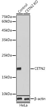 [KO Validated] CETN2 Rabbit pAb