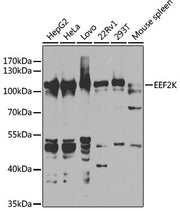 [KO Validated] EEF2K Rabbit pAb