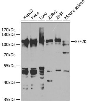 [KO Validated] EEF2K Rabbit pAb