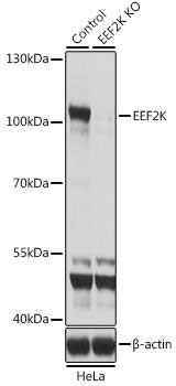 [KO Validated] EEF2K Rabbit pAb