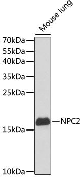 NPC2 Rabbit pAb