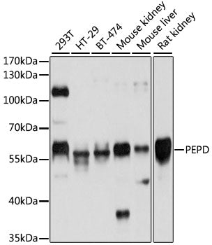 PEPD Rabbit pAb