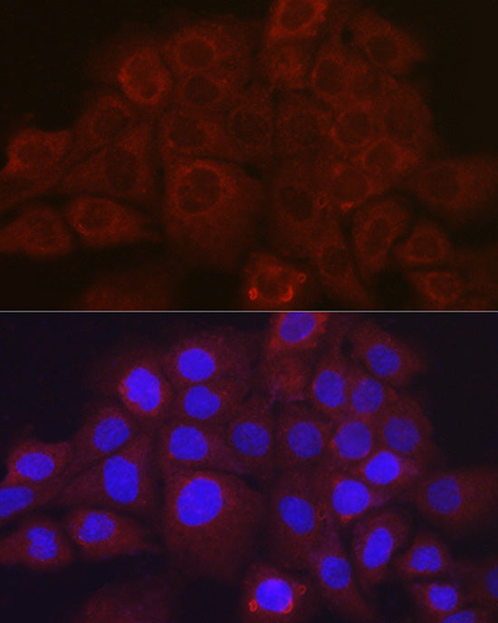SSCA1/SerpinB3 Rabbit pAb