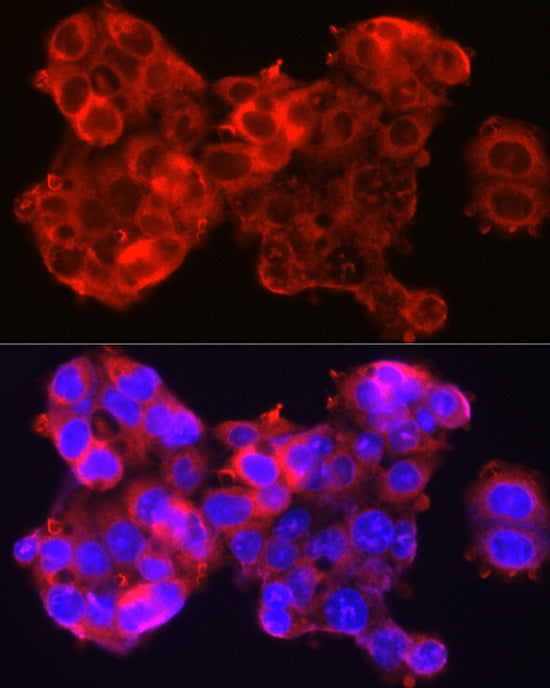 SSCA1/SerpinB3 Rabbit pAb