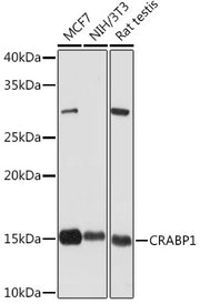 CRABP1 Rabbit mAb