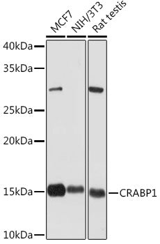 CRABP1 Rabbit mAb