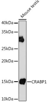 CRABP1 Rabbit mAb