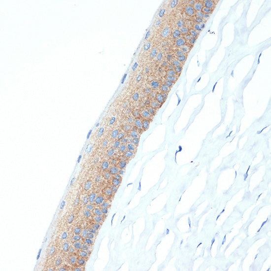 CRABP1 Rabbit mAb