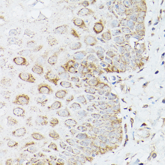 Glutamine Synthetase (GLUL) Rabbit pAb