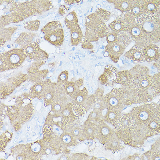 Glutamine Synthetase (GLUL) Rabbit pAb