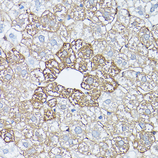 Glutamine Synthetase (GLUL) Rabbit pAb