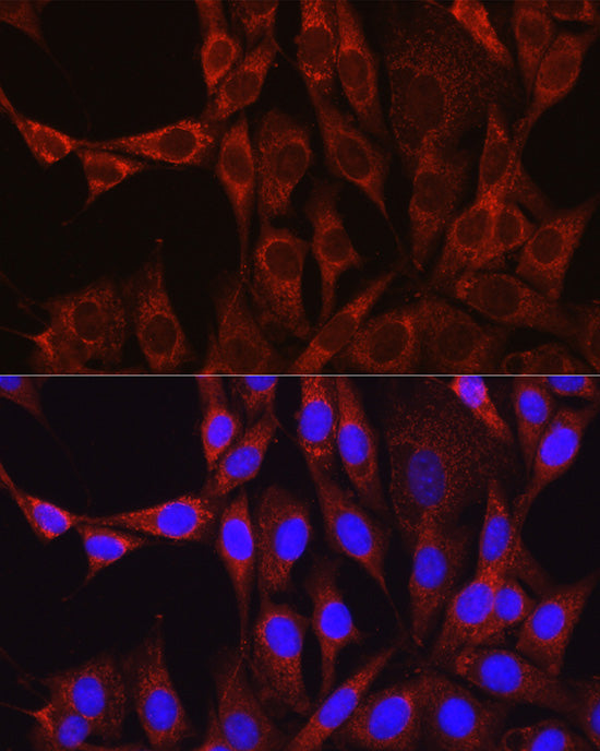 Glutamine Synthetase (GLUL) Rabbit pAb