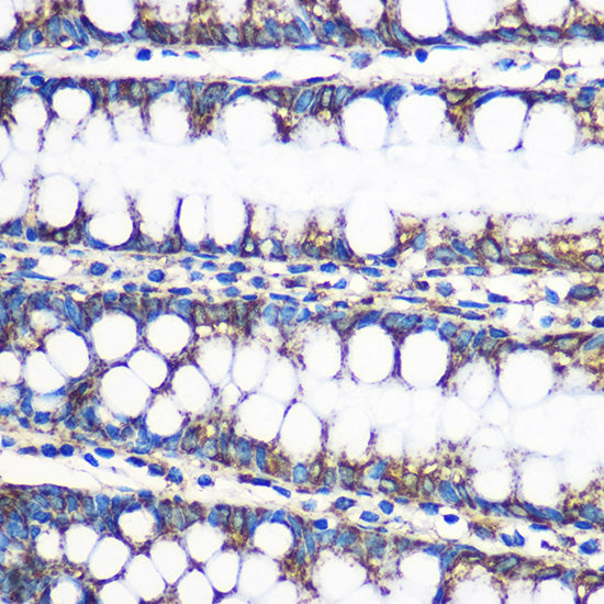 ERAB/HSD17B10 Rabbit pAb