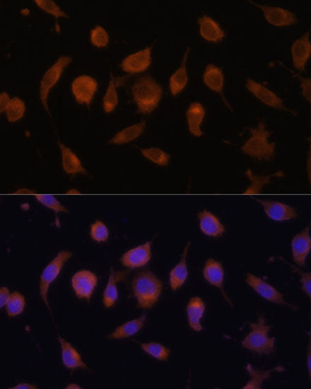 [KO Validated] HIF1AN/FIH1 Rabbit pAb