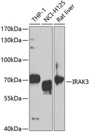 IRAK3 Rabbit pAb