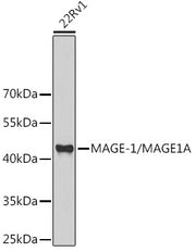 MAGE-1/MAGE1A Rabbit pAb