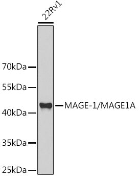 MAGE-1/MAGE1A Rabbit pAb