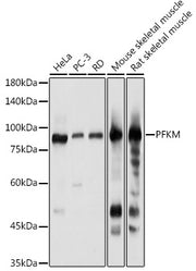 PFKM Rabbit pAb