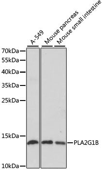 PLA2G1B Rabbit pAb