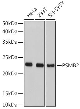 PSMB2 Rabbit pAb