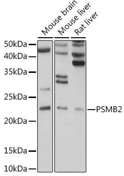 PSMB2 Rabbit pAb