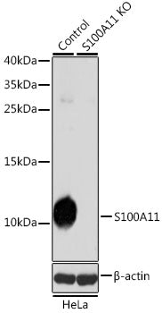 [KO Validated] S100A11 Rabbit pAb