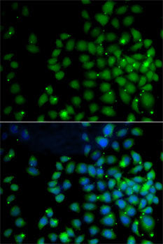 FAT10/UBD Rabbit pAb