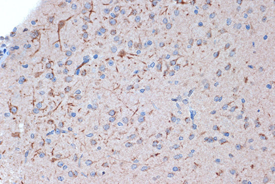 Syntenin Rabbit mAb