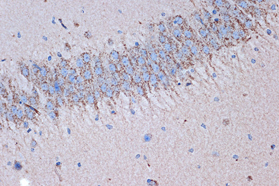Syntenin Rabbit mAb