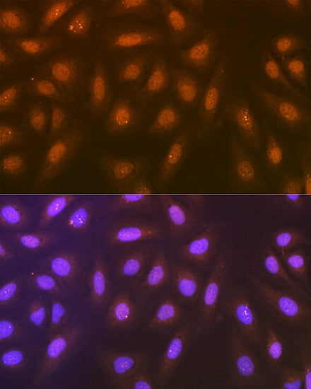 Syntenin Rabbit mAb