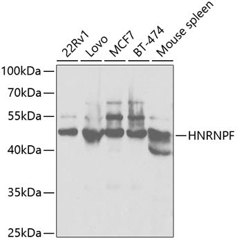 [KO Validated] HNRNPF Rabbit pAb