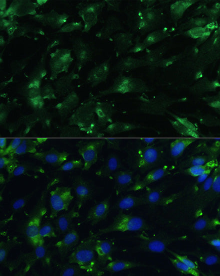 CGRP Rabbit pAb