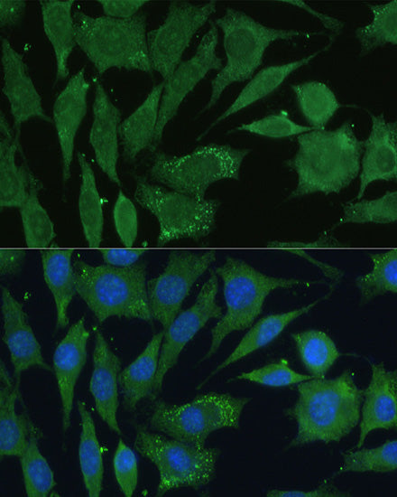 CGRP Rabbit pAb