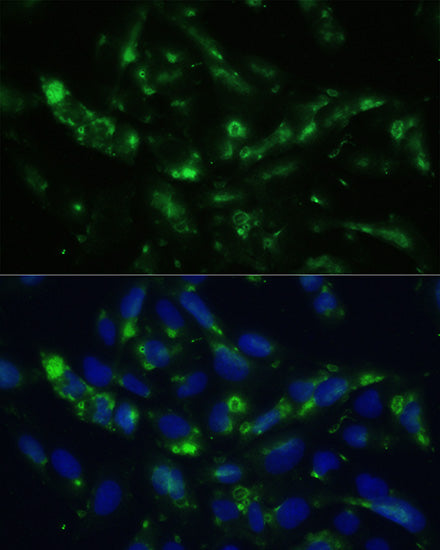 CGRP Rabbit pAb