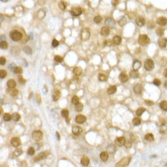 RING1B/RNF2 Rabbit pAb