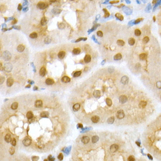 RING1B/RNF2 Rabbit pAb